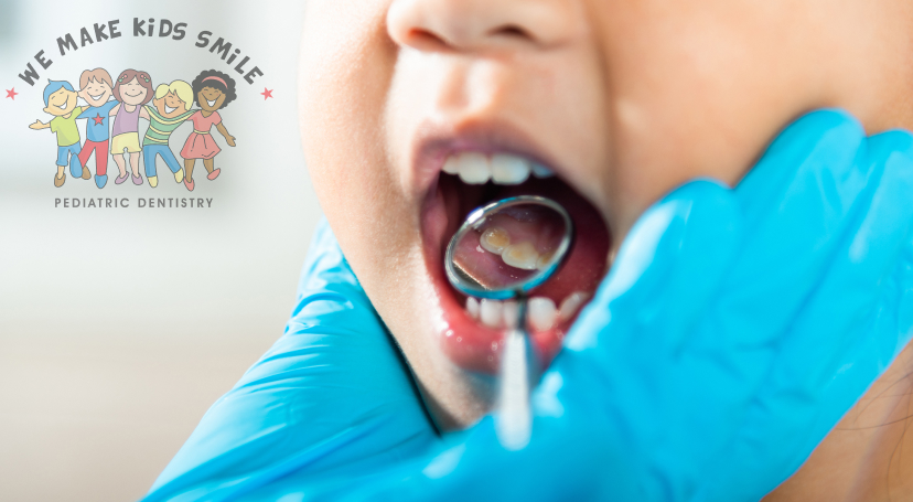 Spot a cavity early on.