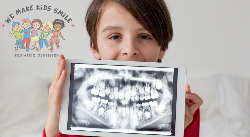 Dental x-rays matter for oral health.